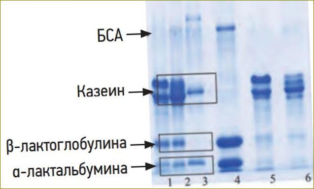 Obrázek 1: DSN elektroforeogram mléčných bílkovin a kaseinové frakce [10]