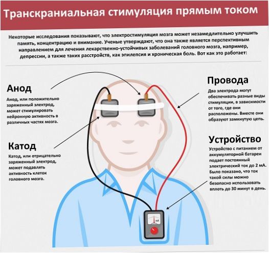 Podstata techniky TDCS